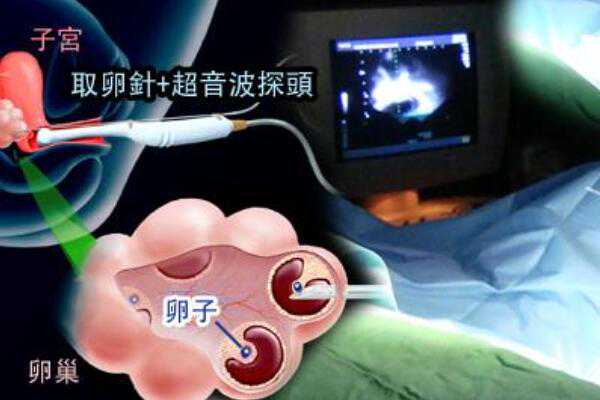 重庆借腹生子市场价格表,重庆试管婴儿机构排名前三甲分别是哪些医院？