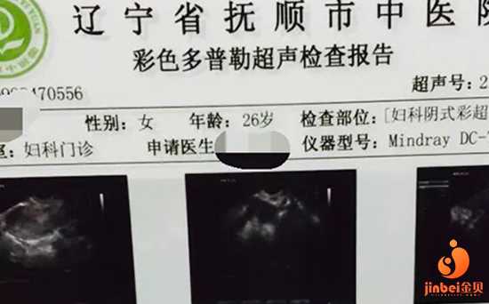 重庆捐卵官网_重庆供卵长相_【国内供卵试管的医院哪里有】我去医院医生说胎